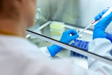 PCR検査の品質管理